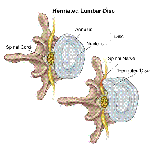 Tiger’s Injury, Surgery, and Prognosis